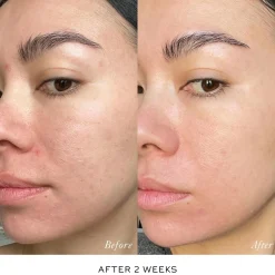 Skin Activator Refill