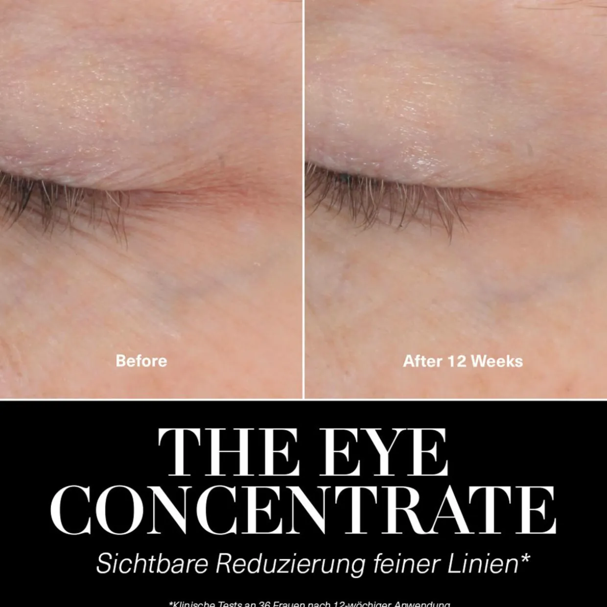 The Eye Concentrate