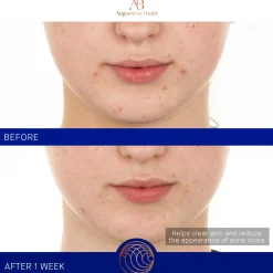 The Retinol Serum