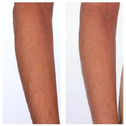 The Sculpt Arm Compound
