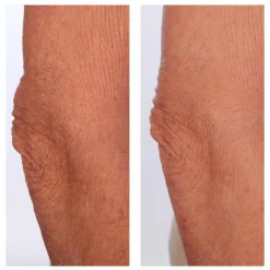 The Sculpt Arm Compound