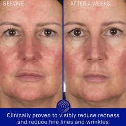 The Hydrogel Face Mask Single