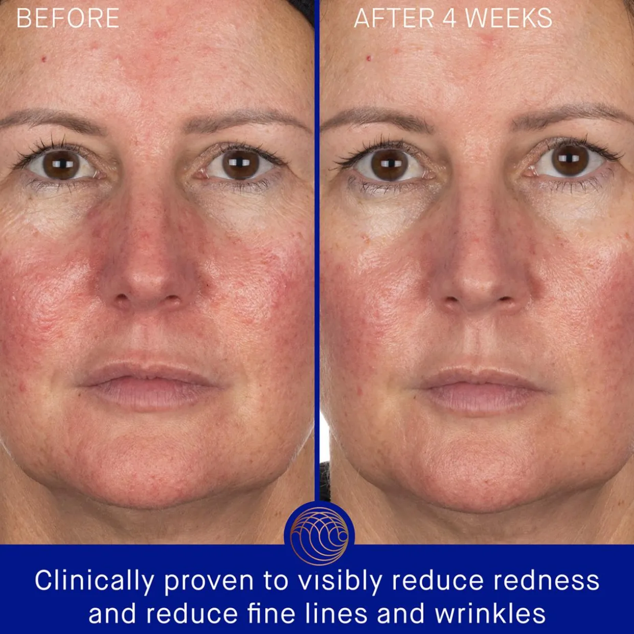 The Hydrogel Face Mask Single