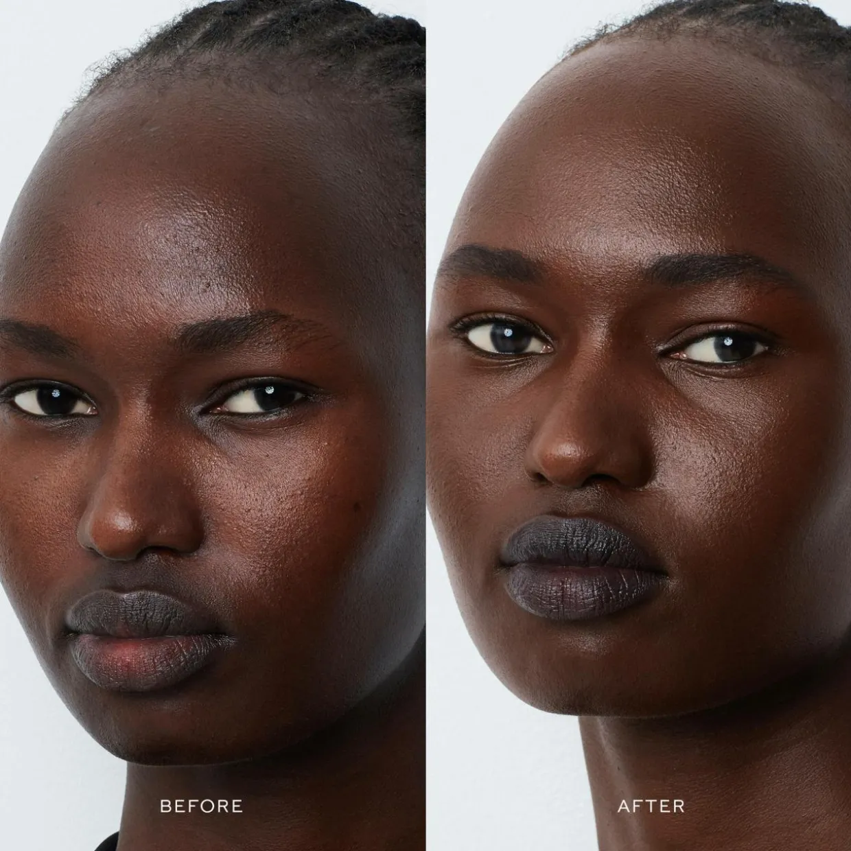 Vital Skincare Complexion Drops XV