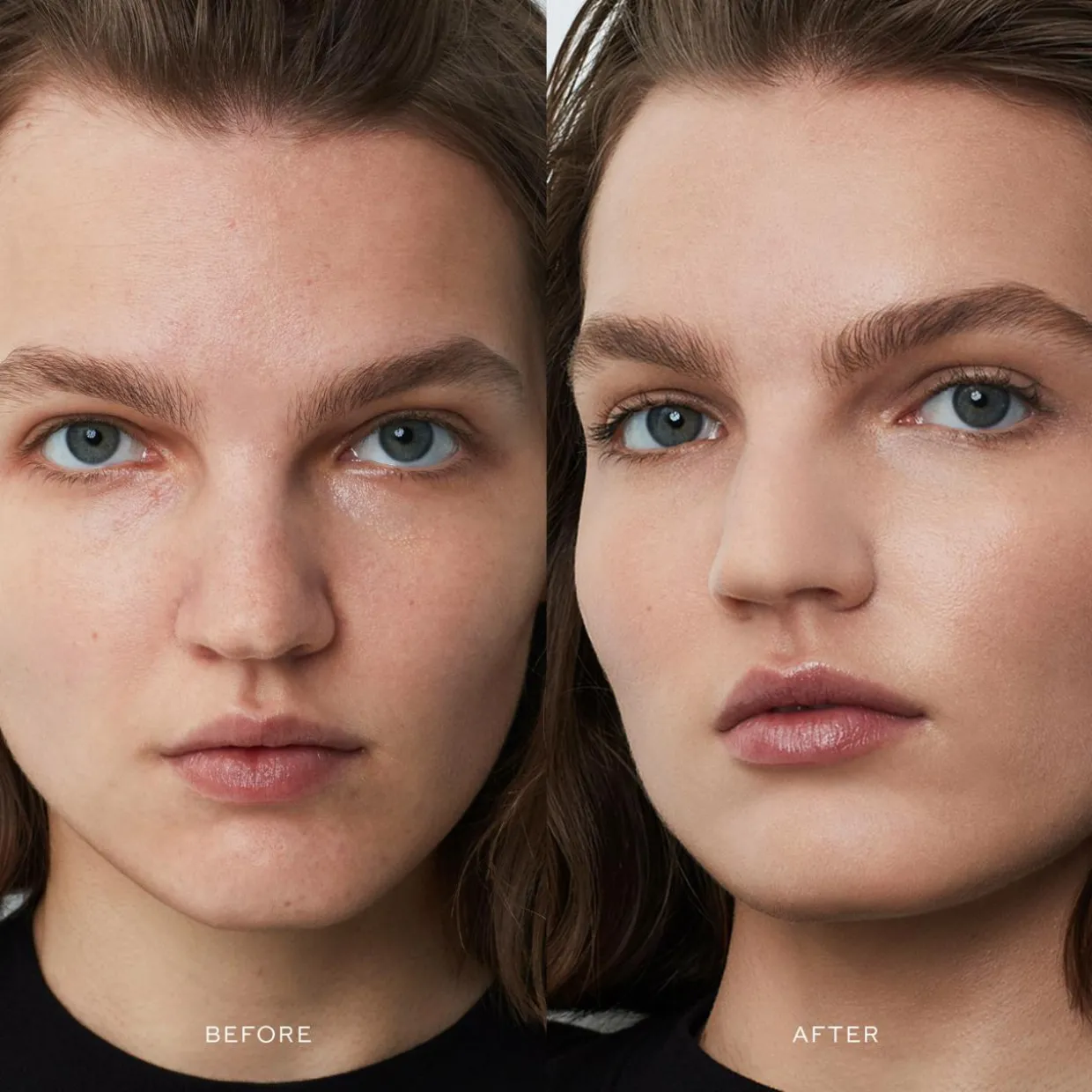Vital Skincare Complexion Drops I