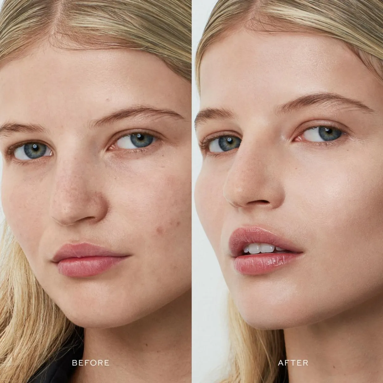 Vital Skincare Complexion Drops 0.5